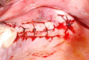 2011 05 13 002 cug3js - Eugenol