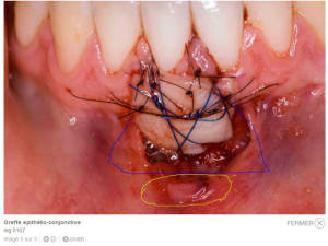 2011 08 22 123852 r6atbw - Eugenol