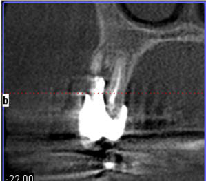 2011 09 15 110154 ls4p4p - Eugenol