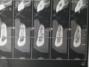 20141125 142307 z6qmcr - Eugenol