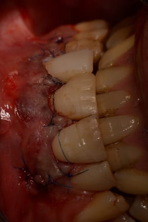 2015 09 09 16.23 - Eugenol