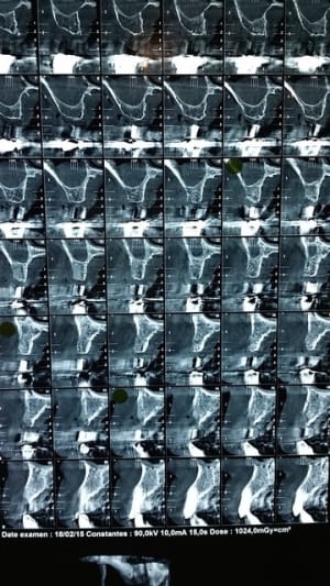 20150220 092048 psryxk - Eugenol