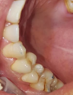 20171006 202647 c5rk4d - Eugenol