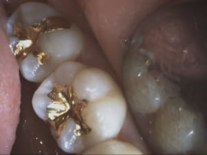2490 video 20180308 142047 kjkhgw - Eugenol