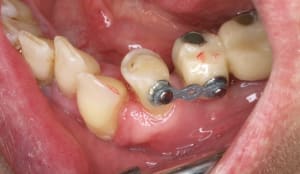 2  3  ebeo9n - Eugenol