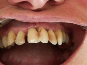 2 cas clinique dr l audibert pamiers  xhoqn6 - Eugenol