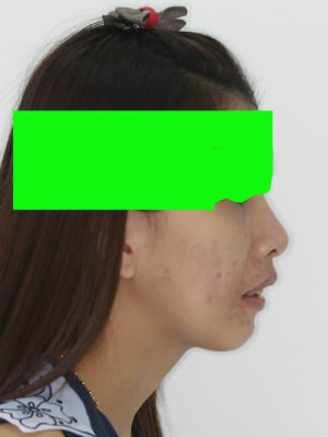 2 ddplmx - Eugenol