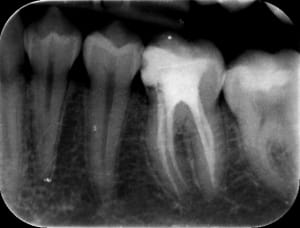 36post bbmcd7 - Eugenol