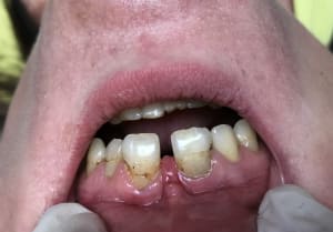 3769580d 3bf7 49aa 967d 6502f71091e1 nd0zmv - Eugenol