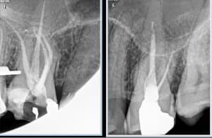 429gyc82vtnbtjv460315tsavg2f - Eugenol
