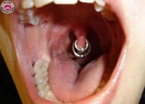 44ffd4a20dec4 tegiuu - Eugenol