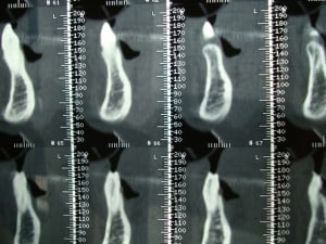 470 gire7s - Eugenol