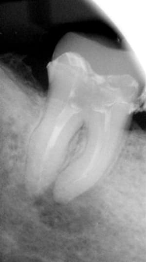 47  caoh anotfu - Eugenol