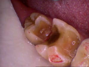 512 wvcdeb - Eugenol