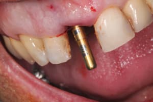 5 naarsc - Eugenol