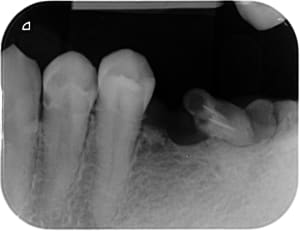 653 x 20151028 160721 xbfwxobs3qk 3 mtdrtm - Eugenol