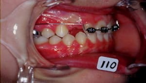 7 pckcyp - Eugenol