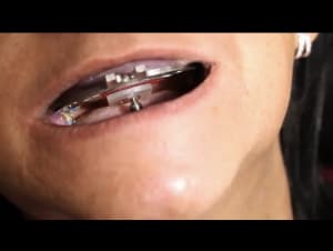 8eafd678 5286 4b9f 8cd1 89999a3573b3 f7kkaw - Eugenol