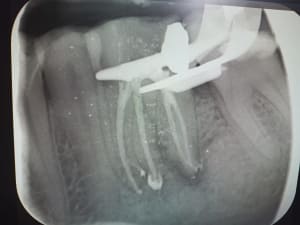 98kgldl8cnb05nhs0bxt0epaf6a4 - Eugenol