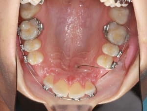9  jpeg s5hhui - Eugenol