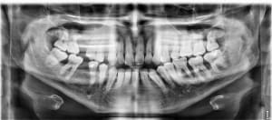 9m8dr6odjun4xiw53mqflglfmxa4 - Eugenol