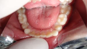 A17 rd6wrb - Eugenol