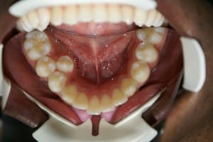 A22 exwdx0 - Eugenol