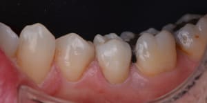 Aaa 7356 nvii1l - Eugenol