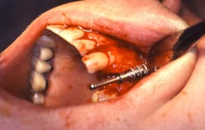 Alexis serge 6 cqahyh - Eugenol