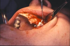 Alexis serge 9 fxuex3 - Eugenol