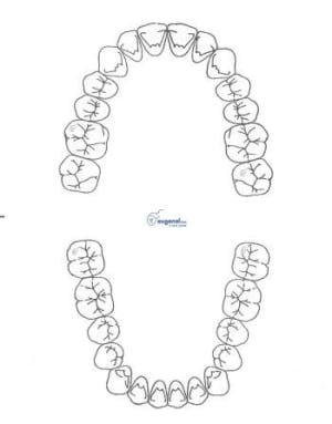 Arcade nonol nk7yc0 - Eugenol
