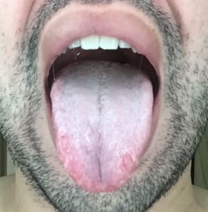 B8fccc3d 17f1 45f7 81ed c6ace26ce3bf c1repr - Eugenol