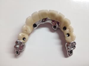 Bridge ccm ewiyre - Eugenol