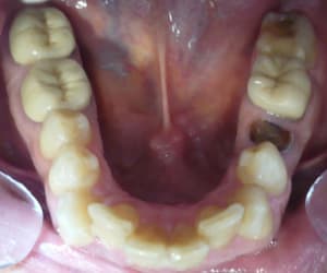Br ma photo inf p0m1rg - Eugenol