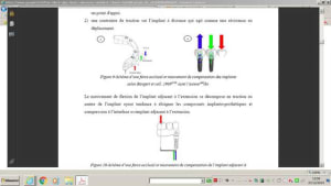Bridge cantilever jsdkl1 - Eugenol