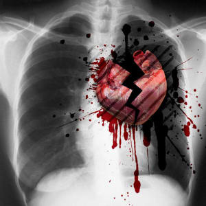 Broken heart t2sglj - Eugenol