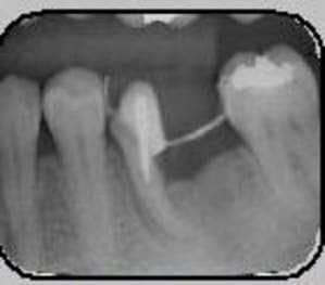 Capture1 buacbf - Eugenol