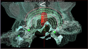 Capture2 sfj4dc - Eugenol