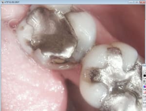 Capture d écran 2017 01 14 15.01 - Eugenol