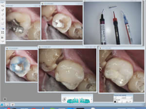 Capture d écran 2017 02 23 12.58 - Eugenol