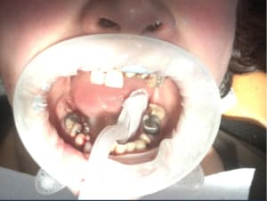 Capture d écran 2017 03 18 20.17 - Eugenol