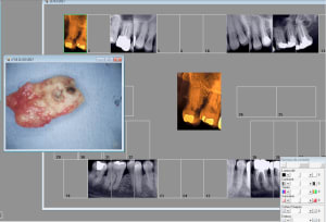 Capture d écran 2017 03 21 15.38 - Eugenol