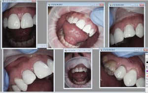 Capture d écran 2017 04 12 22.30 - Eugenol