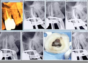 Capture d écran 2017 06 27 07.46 - Eugenol