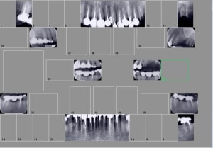 Capture d écran 2017 06 27 11.50 - Eugenol