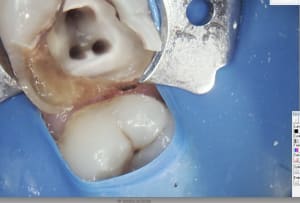 Capture d écran 2017 11 14 22.13 - Eugenol