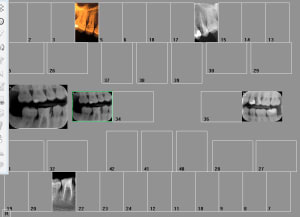 Capture d écran 2017 11 20 20.22 - Eugenol