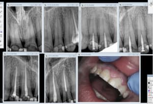 Capture d e cran 2016 04 22 12.56 - Eugenol