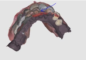 Capture mru7tg - Eugenol