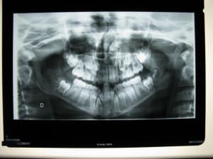 Copie de  clement pano 006 vwue67 - Eugenol